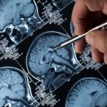 Brain Scan With Hand & Pen Pointing